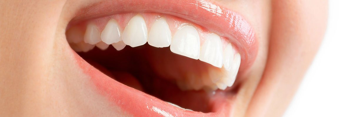 Clareamento dental com laser